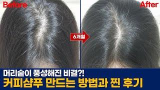 탈모걱정 사라지는 커피샴푸 6개월 실제 사용후기