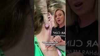 Преображения Бони: как обезопасить себя от неудачной пластики? #пластикалица #иринабаранова #пшб
