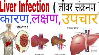 Liver Kharab Hone Ke Lakshan, | Liver Damage Symptoms and Sign Explained..