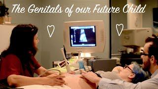 The "Gender" of Our Baby Revealed at the 20 Week Sonogram