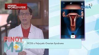 Ano ang dahilan sa pagkakaroon ng PCOS o Polycystic Ovarian Syndrome? | Pinoy MD