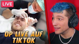 Julienco übertreibt mit Werbung für Haartransplantation | Rezo reagiert