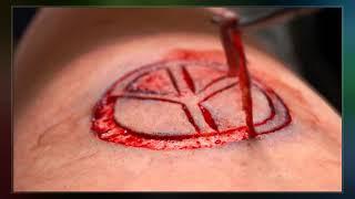 Scarification