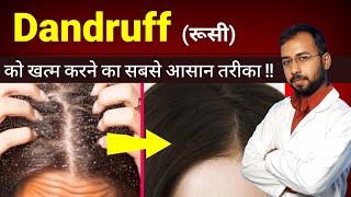 Dandruff ( रुसी ) खत्म करने का सबसे आसान तरीका | dandruff treatment at home | cause of hairfall