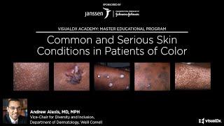 Common and Serious Skin Conditions in Patients of Color