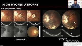 AIOC2021 - GP281 - Topic -  Dr Dilraj S Grewal