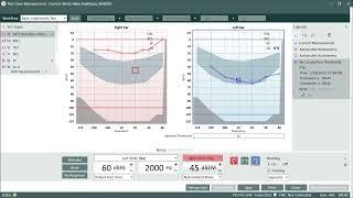 Audiometric Masking In Auditdata Measure