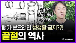 의사들이 뼈가 정액으로 만들어 졌다고 믿으면 벌어지는일... 골절 치료의 역사 | 의학의 역사 골절 편