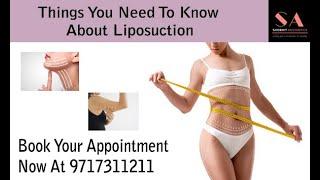 Things You Should Know About Liposuction Treatment | Dr. Shobhit Gupta