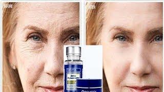 Revitol Phytoceramides Review - Before and After