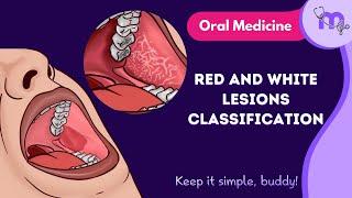 Red and White Lesions Classification  | Full Video | Oral Medicine | Medi Study Go