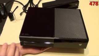 Xbox One Day One Edition Unboxing