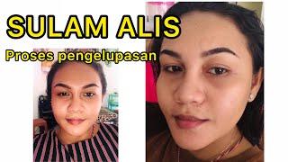 Proses pengelupasan sulam alis || English sub