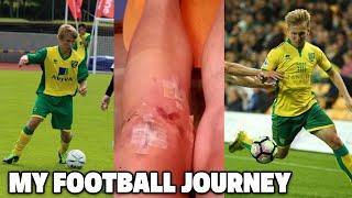 Becoming A Professional Footballer - ACL Surgery, Being Released & Academy Truth.. (My Pro Journey)