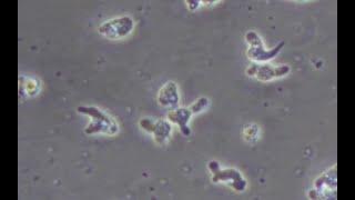 Naegleria fowleri under a microscope in real-time.