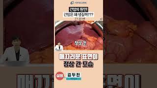 간암의 원인! 간염과 간암 #가천대길병원 #길병원 #명의