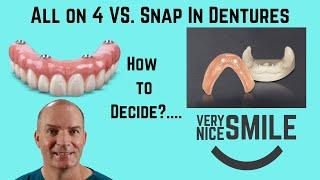 All on 4 or Snap in dentures? Some points to consider.