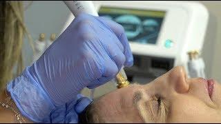 Radio Frequency Facial: What To Expect?