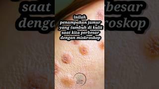 penampakan jamur kulit ketika di zoom dengan miskroskop #ilmu #jamur #panu #gatalkulit #shorts