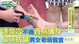 湧泉穴不通百病纏身 腳底拔罐男女老幼皆宜 健康2.0