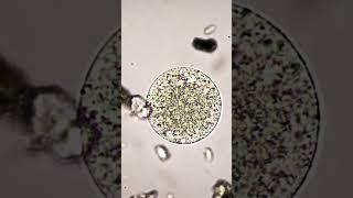Bacterial reproduction #history #earth