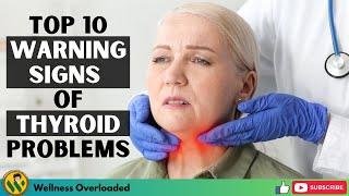 Top 10 Warning Signs of Thyroid Problems (Over 60s must watch)