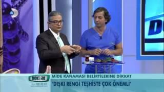 Mide kanaması belirtileri nelerdir?
