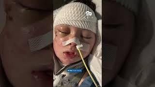Miracle recovery: Whitfield County girl returns home after overcoming severe accident