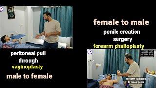 Gender change surgery bangalore delhi hyderabad chennai trivendrum bangladesh dhaka pune coimbatore