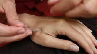 Acupuncture in Boise, Idaho