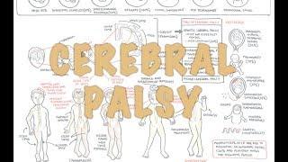 Cerebral Palsy - (DETAILED) Overview