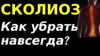 СКОЛИОЗ / причина искривления позвоночника и как легко и просто избавиться от сколиоза