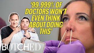 Dr. Paul Nassif's Most INCREDIBLE Nose & Skin Transformations | Botched | E!