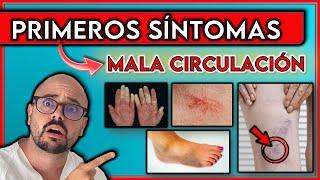 ESTOS son los PRIMEROS SÍNTOMAS de una MALA CIRCULACIÓN || Indican PROBLEMAS de CIRCULACIÓN