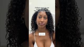 Patient is TIRED OF LOOKING TIRED - Plastic Surgery Helped Her! 