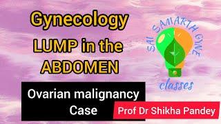 Gynecology clinical case discussion lump in abdomen, Ovarian malignancy  1 @saisamarthgyneclasses