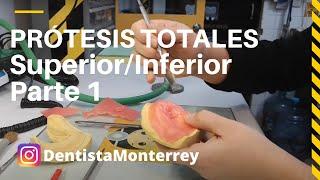 PASOS Prácticos #ProtesisTotales Parte1 Modelos primarios #DentaduraCompleta