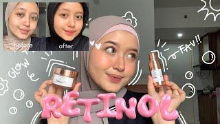 Ngomongin + Review Retinol, EMANG RETINOL SENGARUH ITU YA?!