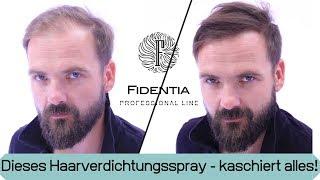 Wieder volles Haar ohne Haarsystem | Transformation mit Mane Haarauffüller Spray