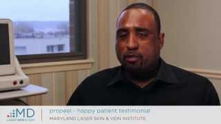 Vivant ProPeel Patient Testimonial | Baltimore Skincare Experts