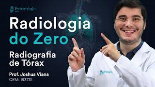 Radiografia de Tórax | Radiologia do Zero