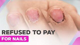 Nail Tech Damaged the Nails | Nail Extensions | Heart Nail Art