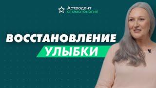 Восстановление улыбки | Астродент, стоматология Ростов-на-Дону