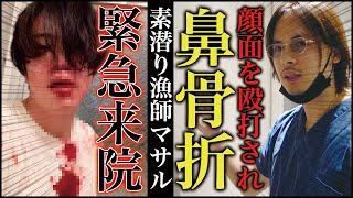 素潜り漁師マサルさんがアマソラクリニックに来院！ネットニュースにもなった暴行事件で骨折した鼻について。