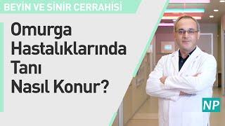 Omurga Hastalıklarında Tanı Nasıl Konur?