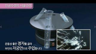 [난임시술] 인공수정 (서울의료원 가임센터) ⓒ한국 머크 #난임치료 #난임센터 #시험관아기 #인공수정 #난임시술 #난임