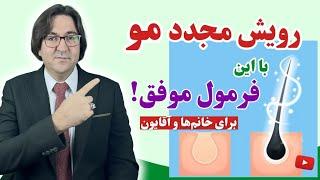 نسخه خانگی مجرب و موفق برای درمان قطعی ریزش مو و رویش مجدد مو به روش دکتر جاوید