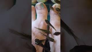  Fish Spa Pedicure | Fish Eat Our Dead Skin!  #shorts