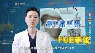 植髮手術該選FUT還是FUE呢｜要怎麼知道哪一種方式適合我？植髮是不是一定要剃頭髮？｜植髮專家謝宗廷醫師分析給你聽