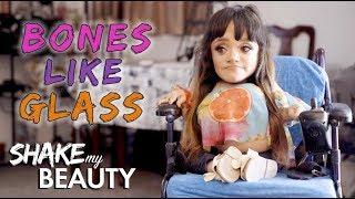 The Make-Up Artist With Bones Like Glass | SHAKE MY BEAUTY